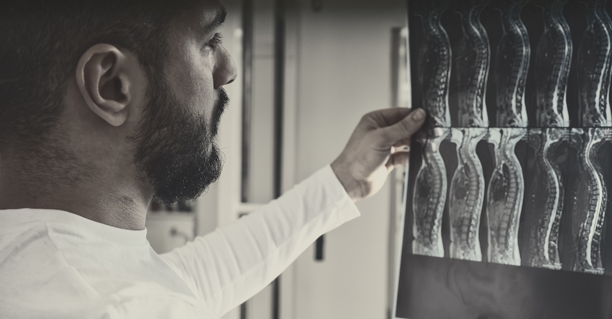 Doctor analyzing a spinal cord injury