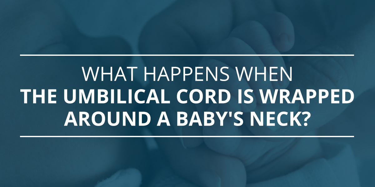 What Causes Umbilical Cord to Wrap Around Baby Neck
