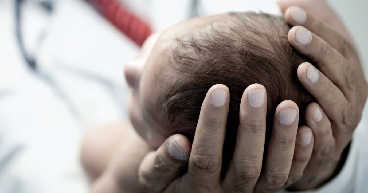What Happens When the Umbilical Cord Is Wrapped Around a Baby’s Neck?