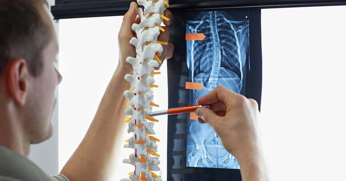 Do Spine Injuries Get Better? | Mandell, Boisclair and Mandell, Ltd