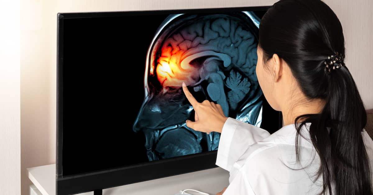 Two Types of Brain Injuries | Mandell, Boisclair and Mandell, Ltd