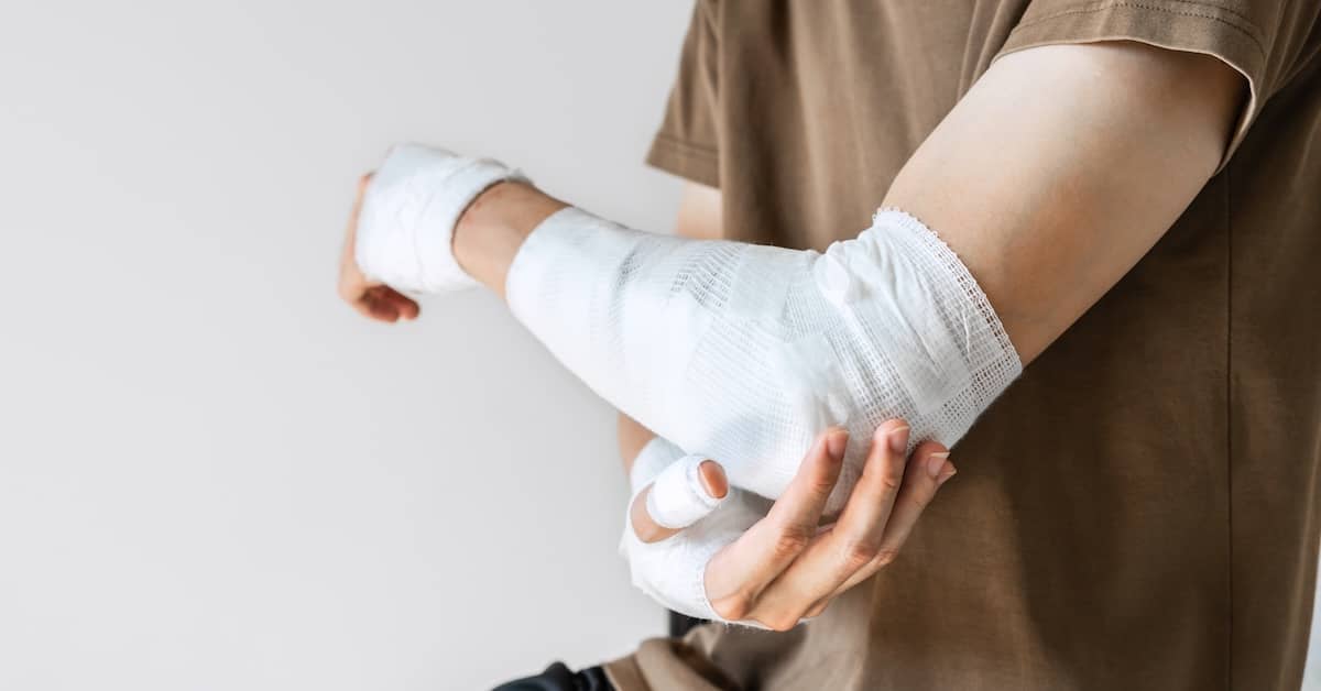 Severe Burn Injuries: Who Can Be Held Liable?